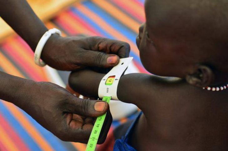 Malnutrition : plus de 700.000 enfants sont touchés au Mali