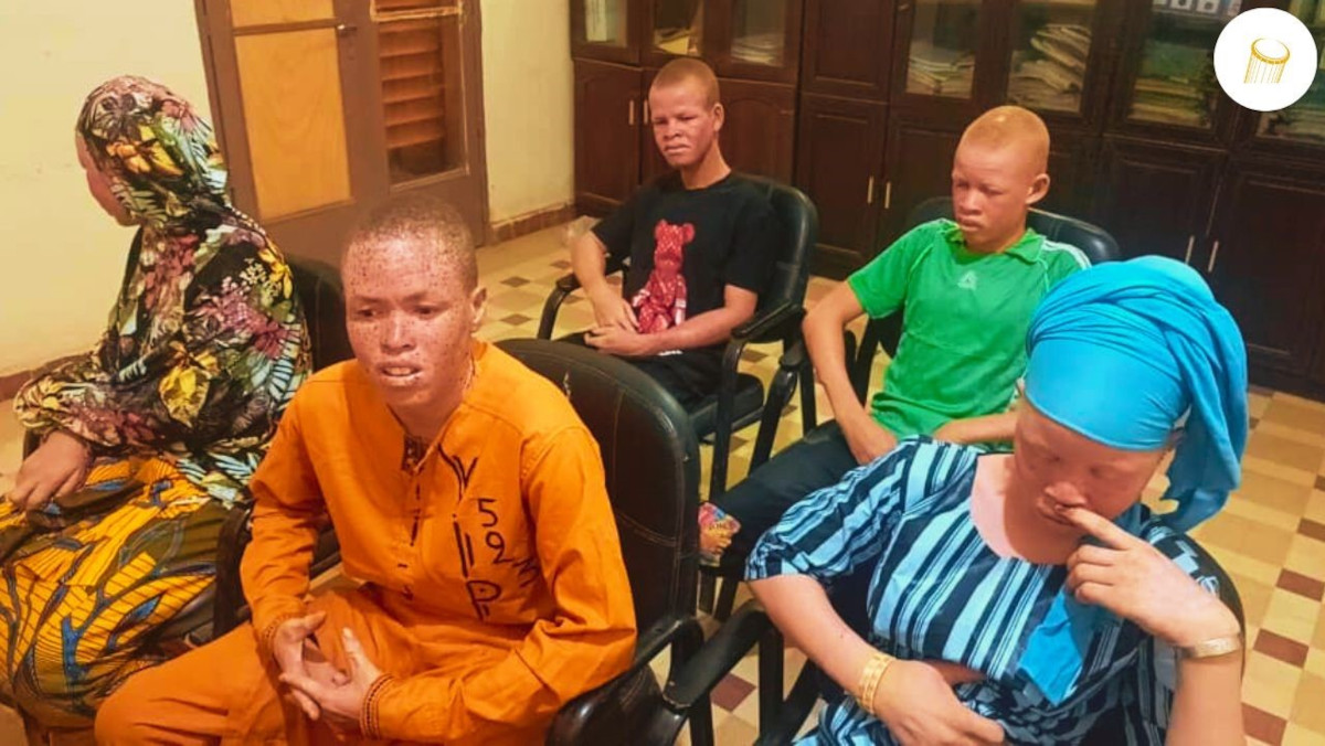 À Diré, l’association des albinos sollicite l’appui des autorités