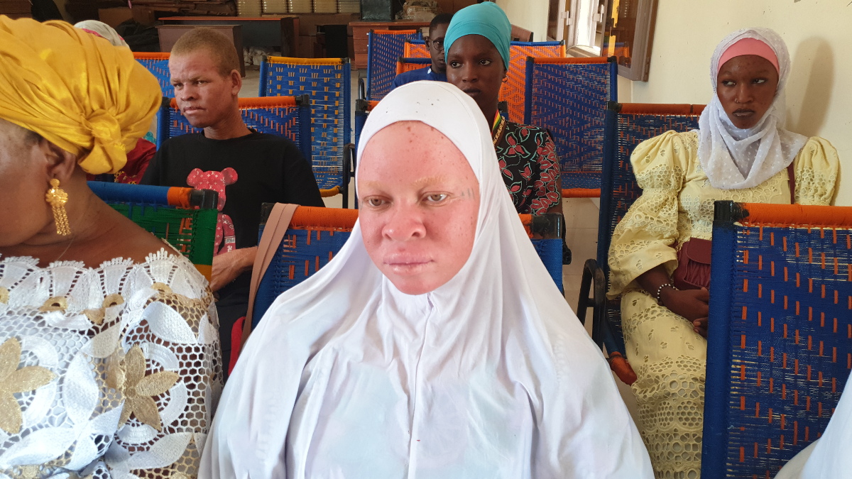 Remise de kits solaire pour les albinos à Diré