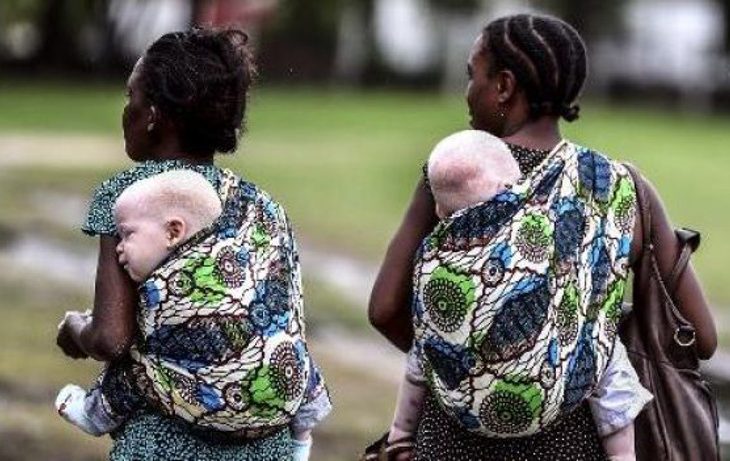 Le Magazine du 13 Juin 2016 : Albinos du Mali, à la recherche de protection